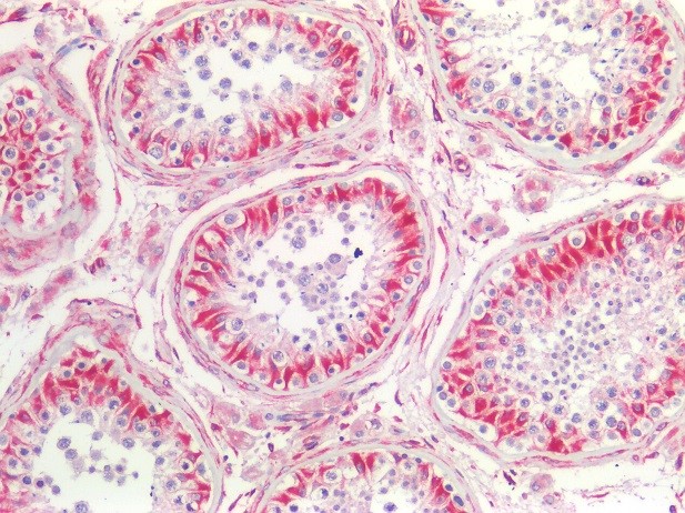 Figure 5. Immunostaining of human paraffin embedded tissue section of testis with MUB1903P (diluted 1:100), showing the specific pattern of vimentin in the mesenchymal cell types, such as fibroblasts in the connective tissue, endothelial cells in blood vessels and Sertoli cells.